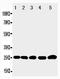 Insulin Like Growth Factor Binding Protein 6 antibody, PA1404, Boster Biological Technology, Western Blot image 