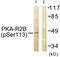 Protein Kinase CAMP-Dependent Type II Regulatory Subunit Beta antibody, abx012484, Abbexa, Western Blot image 