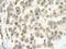 Glypican 3 antibody, GTX47449, GeneTex, Immunohistochemistry paraffin image 