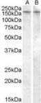 Arginine Vasopressin Receptor 1B antibody, NB100-96917, Novus Biologicals, Western Blot image 