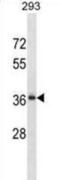RALY RNA Binding Protein Like antibody, abx031391, Abbexa, Western Blot image 