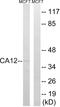 Carbonic Anhydrase 12 antibody, LS-B13430, Lifespan Biosciences, Western Blot image 