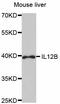 Interleukin 12B antibody, STJ111086, St John