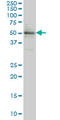 ETS Variant 5 antibody, LS-C197166, Lifespan Biosciences, Western Blot image 