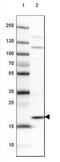 Centromere Protein M antibody, NBP2-34079, Novus Biologicals, Western Blot image 