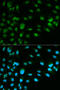 Minichromosome Maintenance Complex Component 7 antibody, 14-005, ProSci, Immunofluorescence image 