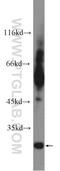 TIMP Metallopeptidase Inhibitor 4 antibody, 12326-1-AP, Proteintech Group, Western Blot image 