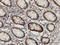 Chromodomain Helicase DNA Binding Protein 3 antibody, LS-C133117, Lifespan Biosciences, Immunohistochemistry paraffin image 