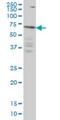 Interleukin 1 Receptor Associated Kinase 3 antibody, H00011213-M04, Novus Biologicals, Western Blot image 