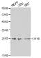 Eukaryotic Translation Initiation Factor 4E antibody, LS-C331949, Lifespan Biosciences, Western Blot image 