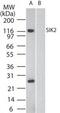 Salt Inducible Kinase 2 antibody, PA1-41208, Invitrogen Antibodies, Western Blot image 