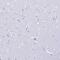 Phospholipase B Domain Containing 1 antibody, PA5-59137, Invitrogen Antibodies, Immunohistochemistry frozen image 