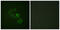 c-met antibody, abx012477, Abbexa, Western Blot image 