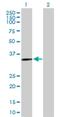 Solute Carrier Family 39 Member 13 antibody, H00091252-B01P, Novus Biologicals, Western Blot image 