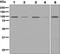 Insulin Receptor antibody, ab131238, Abcam, Western Blot image 