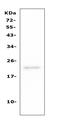 CD81 Molecule antibody, A01281-2, Boster Biological Technology, Western Blot image 