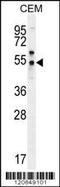 Folate Hydrolase 1B antibody, 56-153, ProSci, Western Blot image 