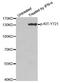 c-Kit antibody, MBS128288, MyBioSource, Western Blot image 