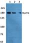 MER Proto-Oncogene, Tyrosine Kinase antibody, A00489, Boster Biological Technology, Western Blot image 