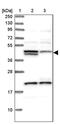 Homocysteine Inducible ER Protein With Ubiquitin Like Domain 1 antibody, PA5-59282, Invitrogen Antibodies, Western Blot image 