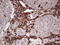 Peripherin antibody, LS-C790818, Lifespan Biosciences, Immunohistochemistry paraffin image 