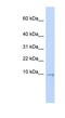 Ubiquinol-Cytochrome C Reductase, Complex III Subunit X antibody, NBP1-62349, Novus Biologicals, Western Blot image 