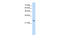 Troponin I1, Slow Skeletal Type antibody, 29-699, ProSci, Western Blot image 