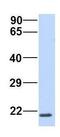 Receptor Accessory Protein 1 antibody, GTX45997, GeneTex, Western Blot image 