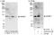 Scm Like With Four Mbt Domains 1 antibody, A303-221A, Bethyl Labs, Western Blot image 