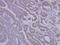 Sorting Nexin 12 antibody, PA5-21774, Invitrogen Antibodies, Immunohistochemistry paraffin image 