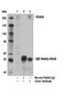 Coiled-Coil Domain Containing 88A antibody, 14200S, Cell Signaling Technology, Immunoprecipitation image 