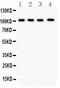 Neuropilin 1 antibody, PB9300, Boster Biological Technology, Western Blot image 