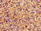 ArfGAP With RhoGAP Domain, Ankyrin Repeat And PH Domain 3 antibody, LS-C677170, Lifespan Biosciences, Immunohistochemistry paraffin image 