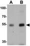Nucleobindin 2 antibody, GTX31531, GeneTex, Western Blot image 