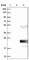 Cysteine Rich Tail 1 antibody, HPA021883, Atlas Antibodies, Western Blot image 