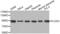 Procollagen-Lysine,2-Oxoglutarate 5-Dioxygenase 3 antibody, abx001859, Abbexa, Western Blot image 