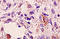 Fms Related Tyrosine Kinase 1 antibody, 250908, Abbiotec, Immunohistochemistry paraffin image 