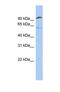 Transmembrane Serine Protease 6 antibody, NBP1-57098, Novus Biologicals, Western Blot image 