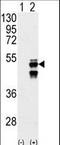 Protein Phosphatase, Mg2+/Mn2+ Dependent 1F antibody, LS-C101051, Lifespan Biosciences, Western Blot image 