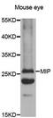 Major Intrinsic Protein Of Lens Fiber antibody, MBS128056, MyBioSource, Western Blot image 