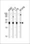 Glutathione S-Transferase Pi 1 antibody, MBS9215166, MyBioSource, Western Blot image 
