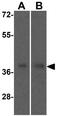 Sirtuin 4 antibody, GTX17074, GeneTex, Western Blot image 