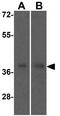 NAD-dependent ADP-ribosyltransferase sirtuin-4 antibody, GTX17074, GeneTex, Western Blot image 