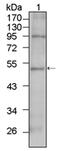 T-Box 5 antibody, AM06346SU-N, Origene, Western Blot image 