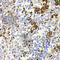 Nuclear Autoantigenic Sperm Protein antibody, A6938, ABclonal Technology, Immunohistochemistry paraffin image 
