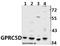 G Protein-Coupled Receptor Class C Group 5 Member D antibody, A13912, Boster Biological Technology, Western Blot image 