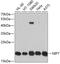 Nucleolar Pre-RRNA Processing Protein NIP7 antibody, GTX64793, GeneTex, Western Blot image 