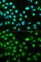 Protein Phosphatase 3 Catalytic Subunit Alpha antibody, GTX32485, GeneTex, Immunocytochemistry image 