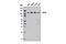 CYLD Lysine 63 Deubiquitinase antibody, 12797S, Cell Signaling Technology, Western Blot image 