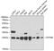 Deoxythymidylate Kinase antibody, GTX54004, GeneTex, Western Blot image 